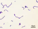 Streptococcus mutans, Gram boyası ile boyanmış