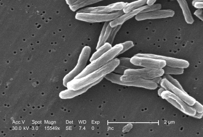 Mycobacterium_tuberculosis_8438_lores.jpg